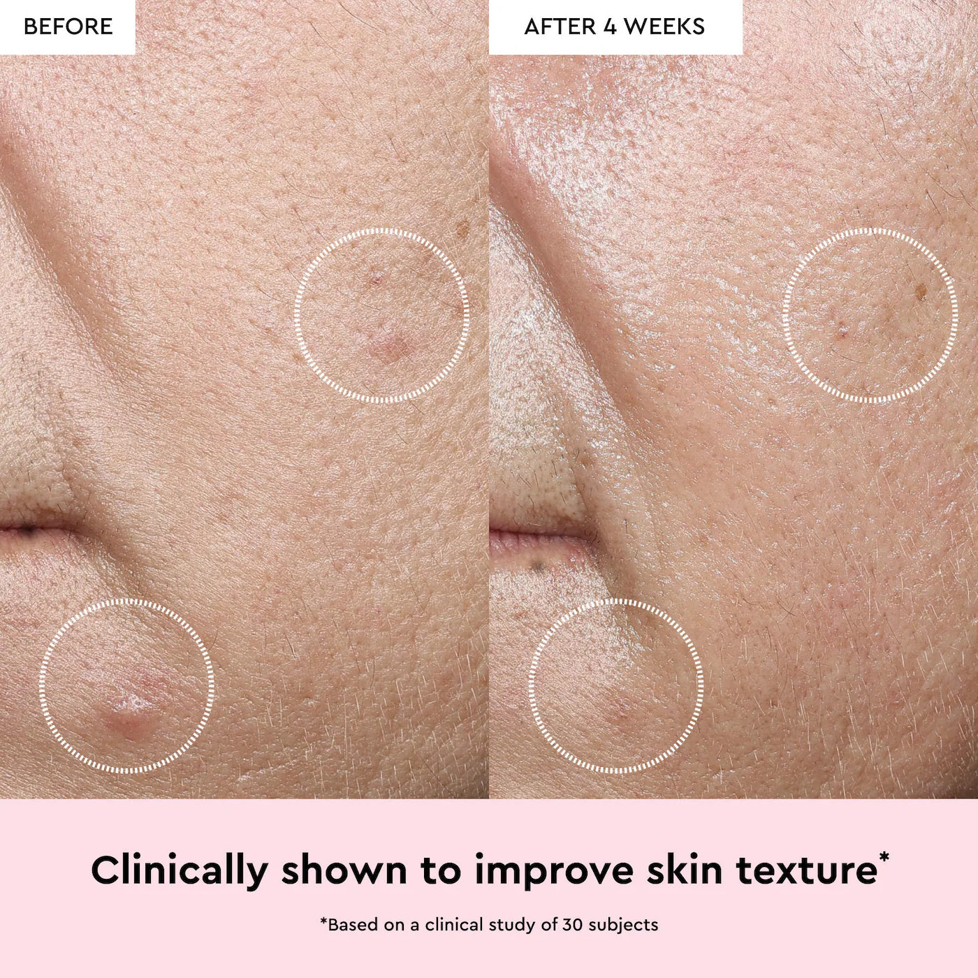 Glow Recipe Mini Watermelon Glow Niacinamide Dew Drops Multipurpose Brightening Serum